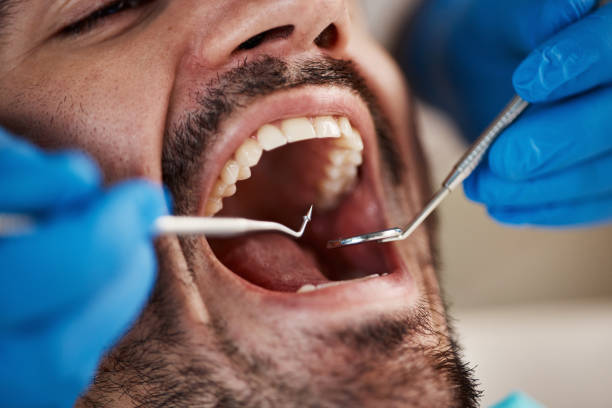 Best Cosmetic Emergency Dentistry in Hickory Creek, TX