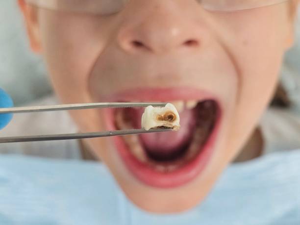 Best Cosmetic Emergency Dentistry in Hickory Creek, TX