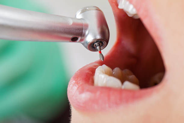 Best Emergency Dental Care for Broken or Chipped Teeth in Hickory Creek, TX